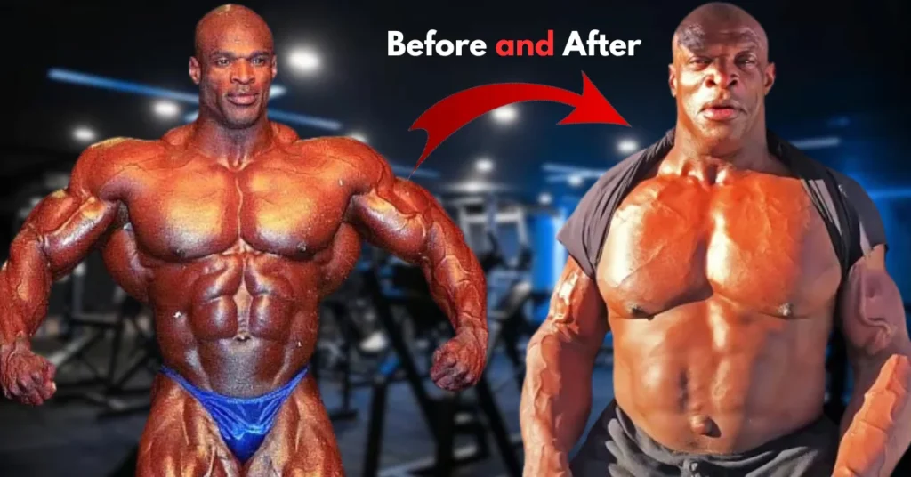 Ronnie Coleman Before and After